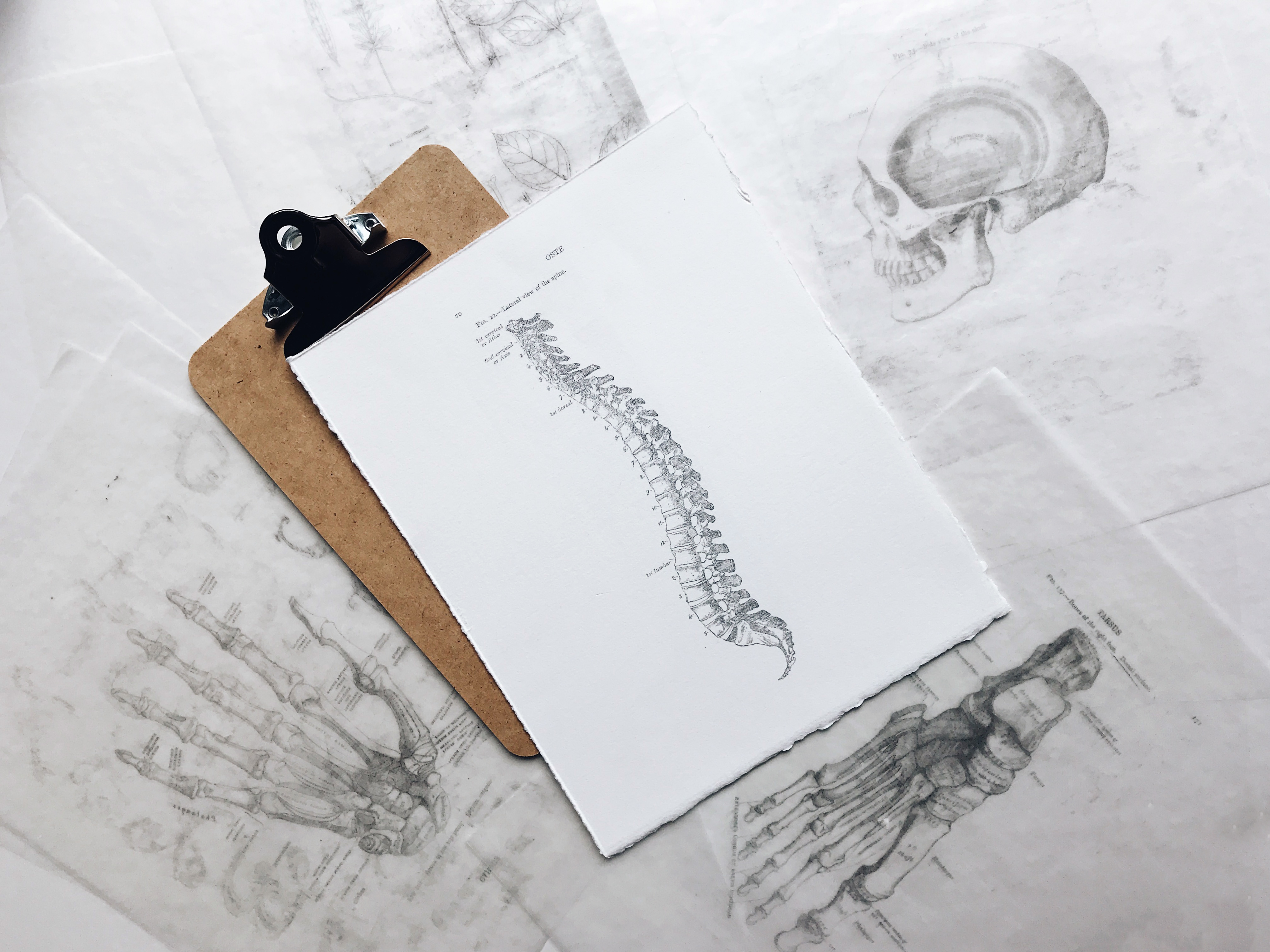 A 19th-century anatomical print showing a lateral view of the spine, resting on a clipboard.